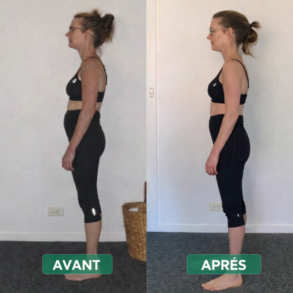 Postupro™ - Correcteur de posture