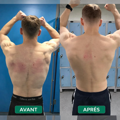 Postupro™ - Correcteur de posture