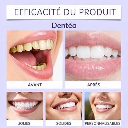 Bandes de blanchiment Violettes - Dentéa